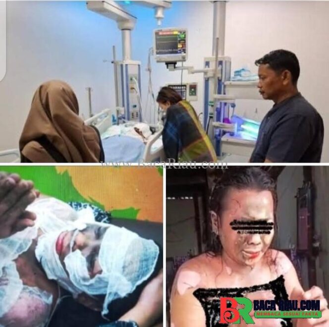 
					Tragis Nian Suami Bakar Istri Sendiri Akhirnya Meninggal Dunia