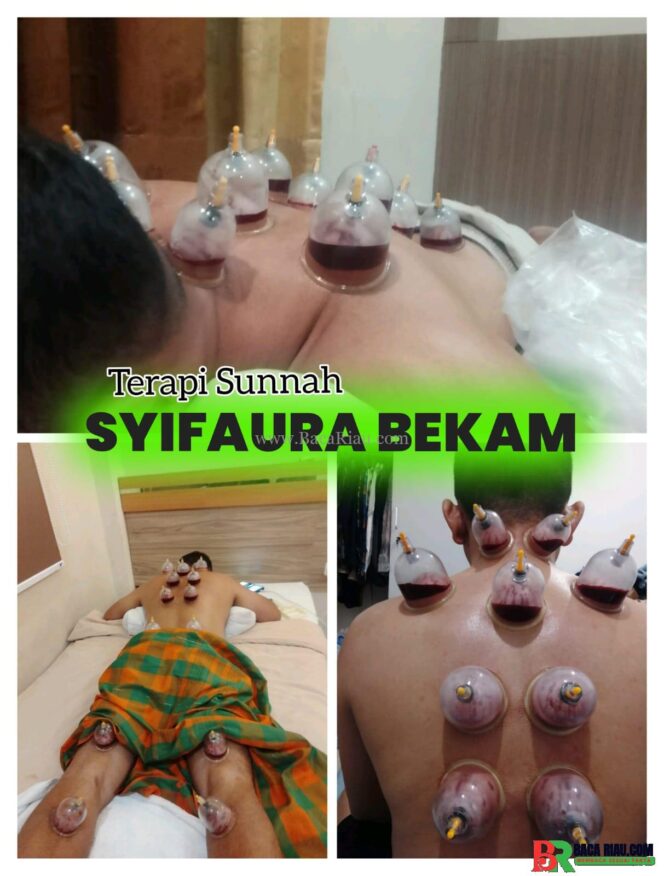 
					Terapi Sunnah Bekam, SYIFAURA BEKAM, Ikhtiar Kesehatan Alami Sesuai Tuntunan Rasulullah 