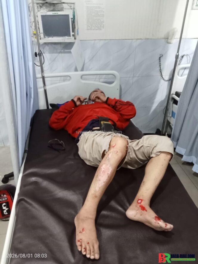 
					Pajero Hantam Tiga Pemotor, Korban Terpental hingga Patah Tulang